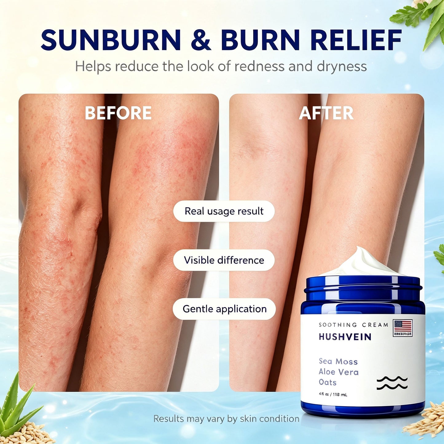 🔥Last Day 50% OFF🎁HUSHVEIN™ Intensive Sea Moss Soothing Cream