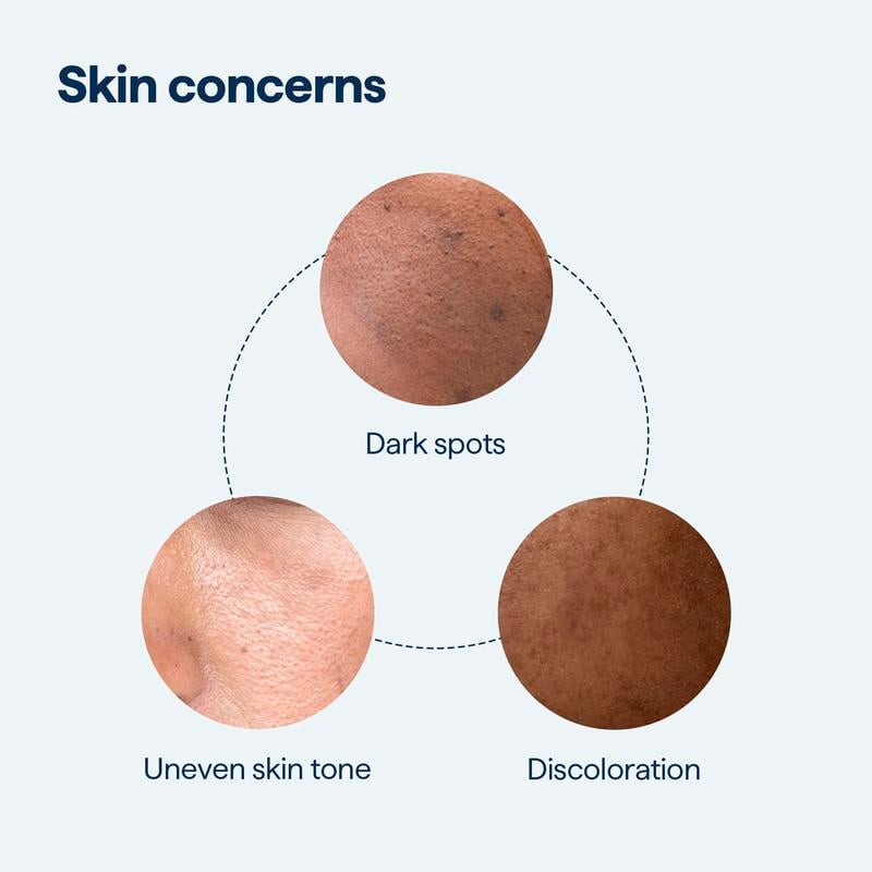 REMEDY for Dark Spots - All-in-One Nightly Serum for Fading Dark Spots & Evening Skin Tone with Retinol, Kojic Acid & Tranexamic Acid