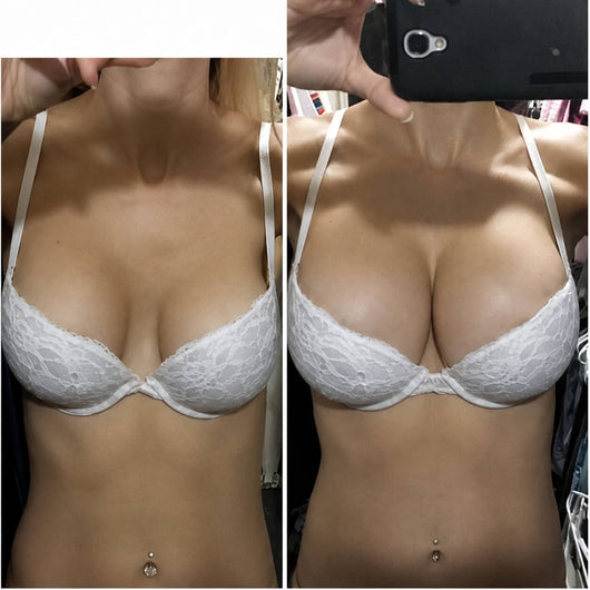 Breast Enhance Mentmicroneedle Patch