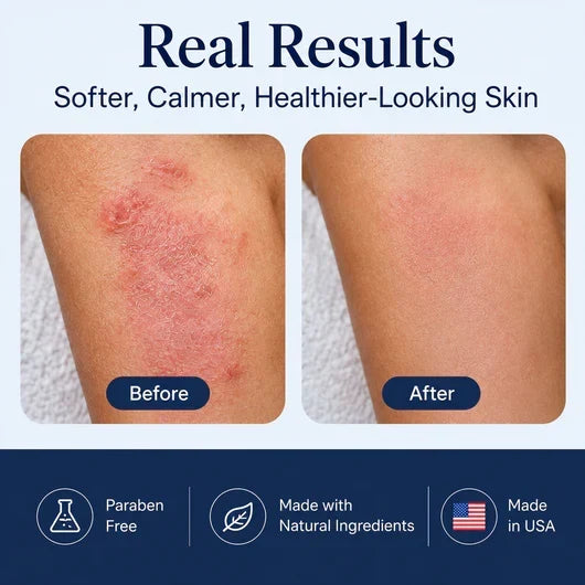 🔥Last Day 50% OFF🎁HUSHVEIN™ Intensive Sea Moss Soothing Cream