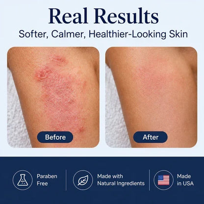 🔥Last Day 50% OFF🎁HUSHVEIN™ Intensive Sea Moss Soothing Cream